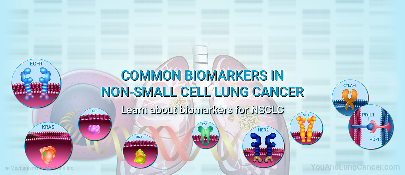 Common Biomarkers in Non-Small Cell Lung Cancer. Learn about biomarkers for NSCLC.