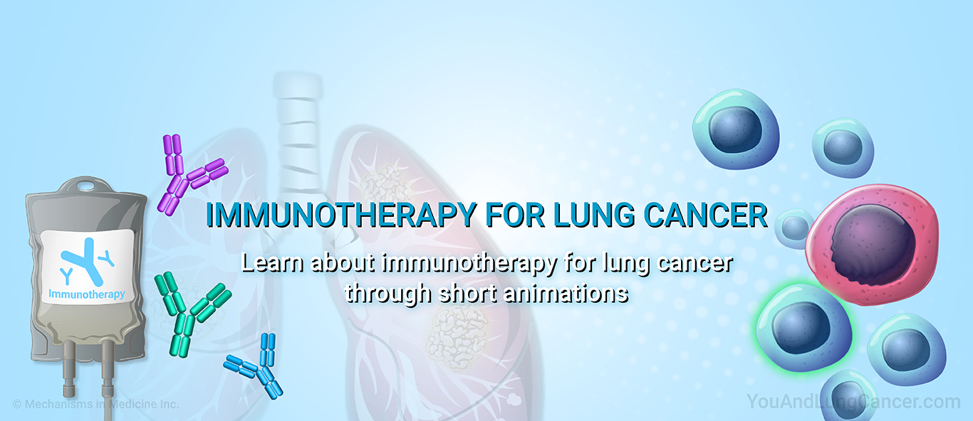 Immunotherapy for Lung Cancer. Learn about immunotherapy for lung cancer through short animations.