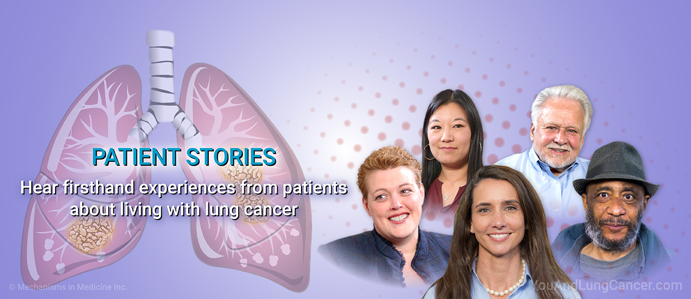 Patient Stories. Hear firsthand experiences from patients about living with lung cancer.