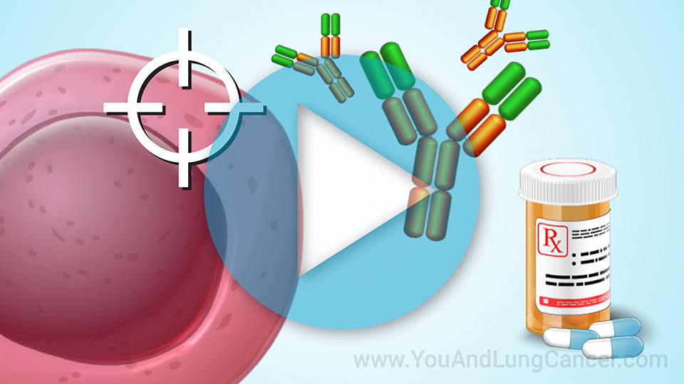 Treatment and Management of Lung Cancer