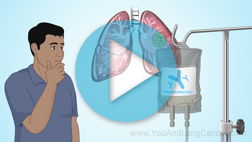 Animation - Immunotherapy Treatments for NSCLC