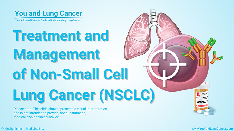 Slide Show - Treatment and Management of NSCLC