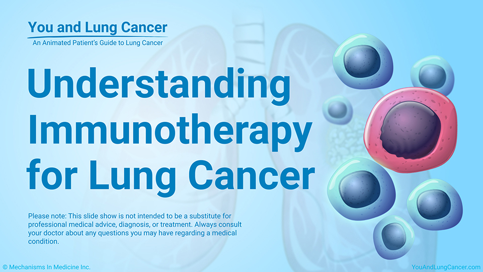 Slide Show - Understanding Immunotherapy for Lung Cancer