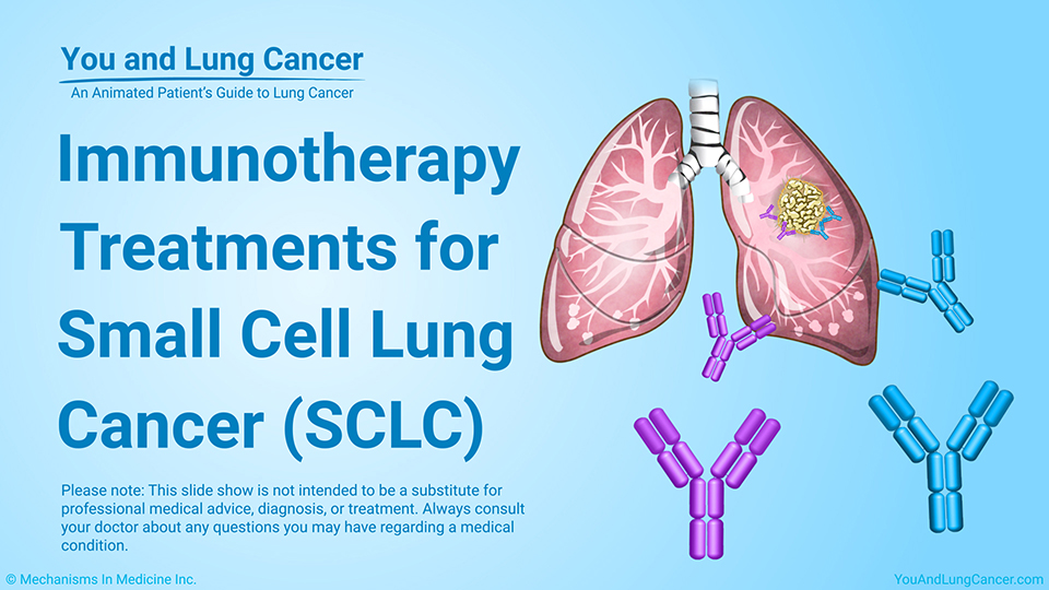 Slide Show - Immunotherapy Treatments for SCLC