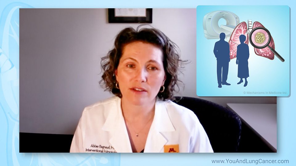 Are there alternatives to screening with low-dose CT scan?